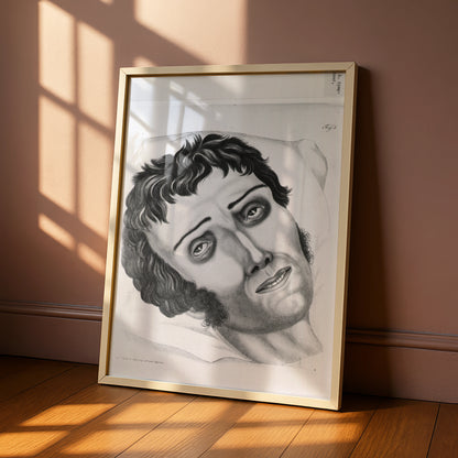 Creepy Vintage Medical Illustration Poster, Halloween Horror Wall Art, Gothic Face Print