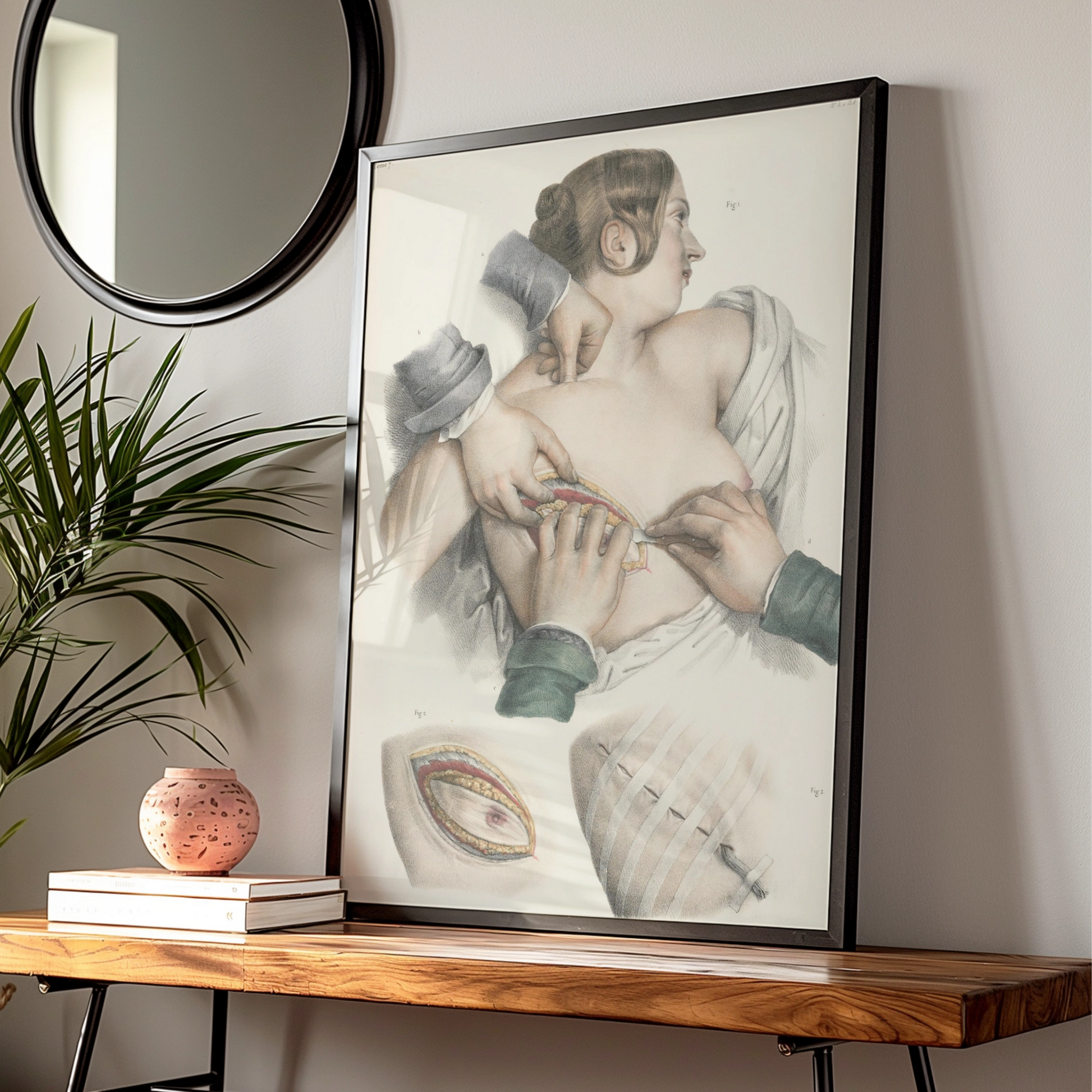 Vintage Medical Anatomy Poster, Victorian Surgical Illustration, Halloween Art Print